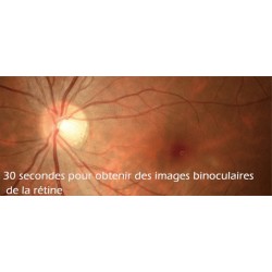 Rétinographe non-mydriatique binoculaire automatique