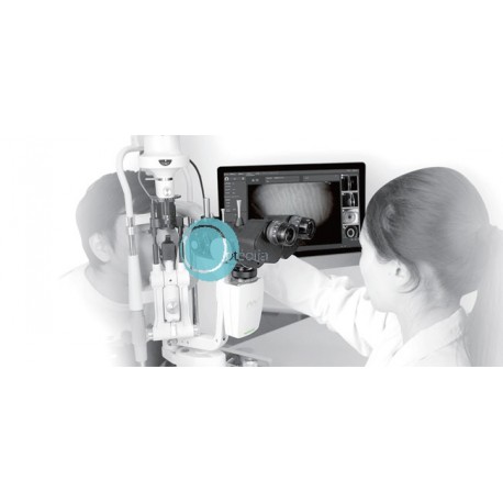 Lampe à fente biomicroscope numérique avec examen glandes de Meibomius