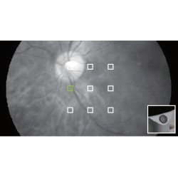 9 cibles de fixation