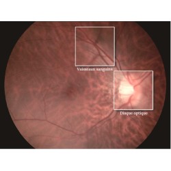 Images Haute résolution