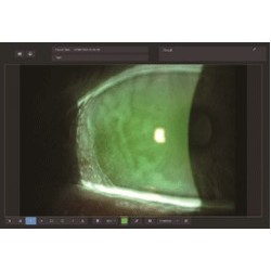 Lampe à fente biomicroscope avec module de digitalisation numérique type Zeiss à 5 facteurs de grossissement