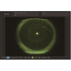 Lampe à fente biomicroscope avec module de digitalisation numérique type Zeiss à 5 facteurs de grossissement