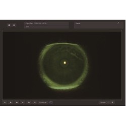 Lampe à fente biomicroscope avec module de digitalisation numérique type Zeiss à 5 facteurs de grossissement