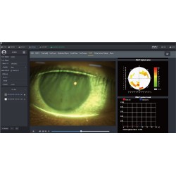Temps de rupture de la fluorescéine