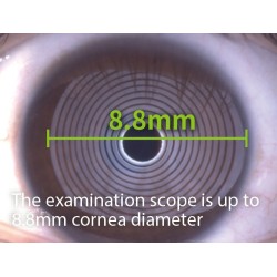 système de projection en anneau Placido avec lumière visible pour effectuer l'examen NIBUT, la portée de l'examen peut atteindre