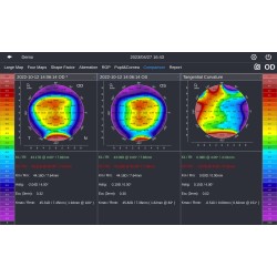 Topographe cornéen DEA 520 fonction de topographie seule