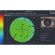 Topographe cornéen DEA 520 fonction de topographie et sécheresse oculaire
