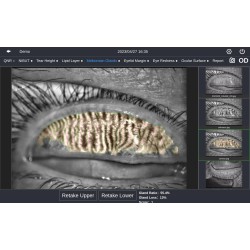 Topographe cornéen DEA 520 fonction de topographie et sécheresse oculaire