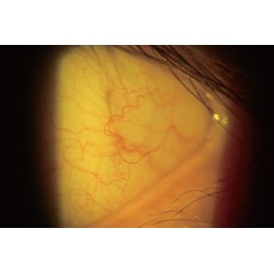 Lampe à fente trois grossissements type Zeiss LED et platine en métal