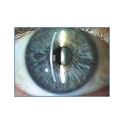 Ensemble salle d'examen de vue CONTACTO pour opticien