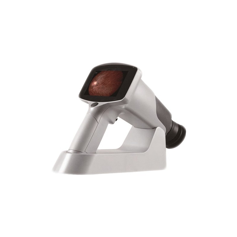 Rétinographe non-mydriatique portable sans fil