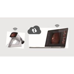 Rétinographe non-mydriatique portable avec synchronisation WiFi
